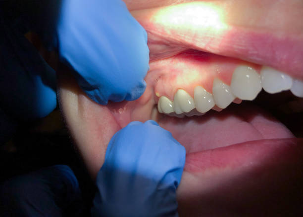 Best Pediatric Emergency Dentist in Eustace, TX