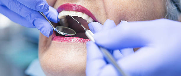 Best Emergency Tooth Extraction in Eustace, TX